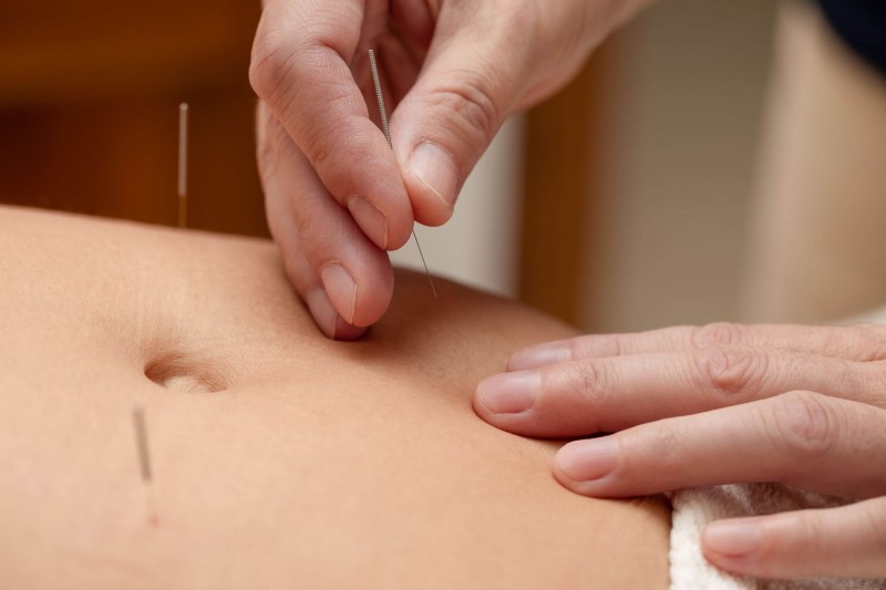 cosmosan praxis für traditionelle chinesische medizin zürich seefeld - akupunktur